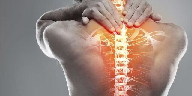 Medical options for cervical osteochondrosis cervical therapy